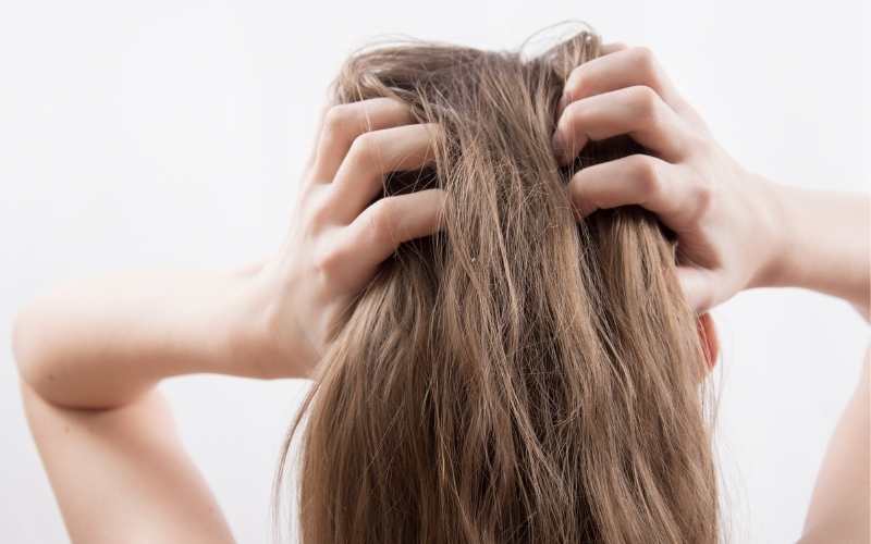 Closeup woman hand itchy scalp | dry scalp treatment